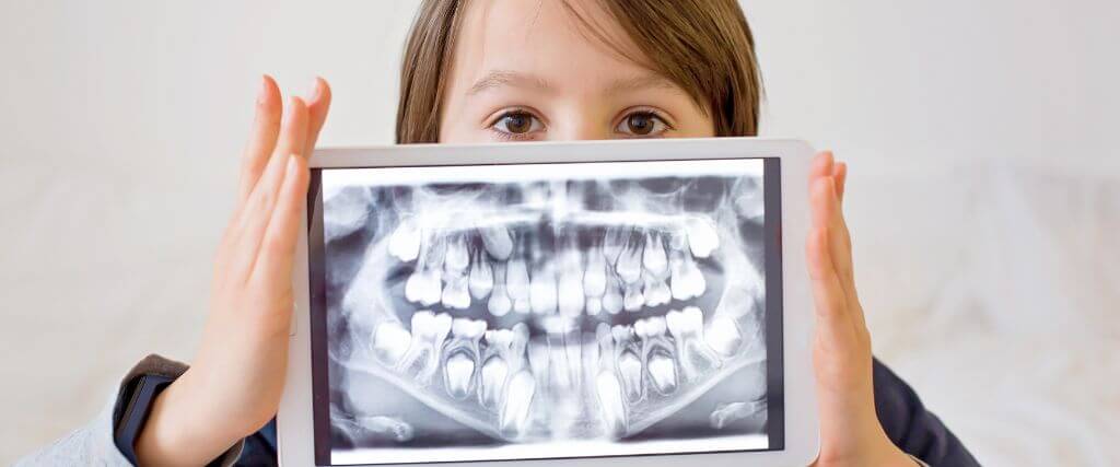 Dental X-Rays: 7 of Your Top Questions, Answered!