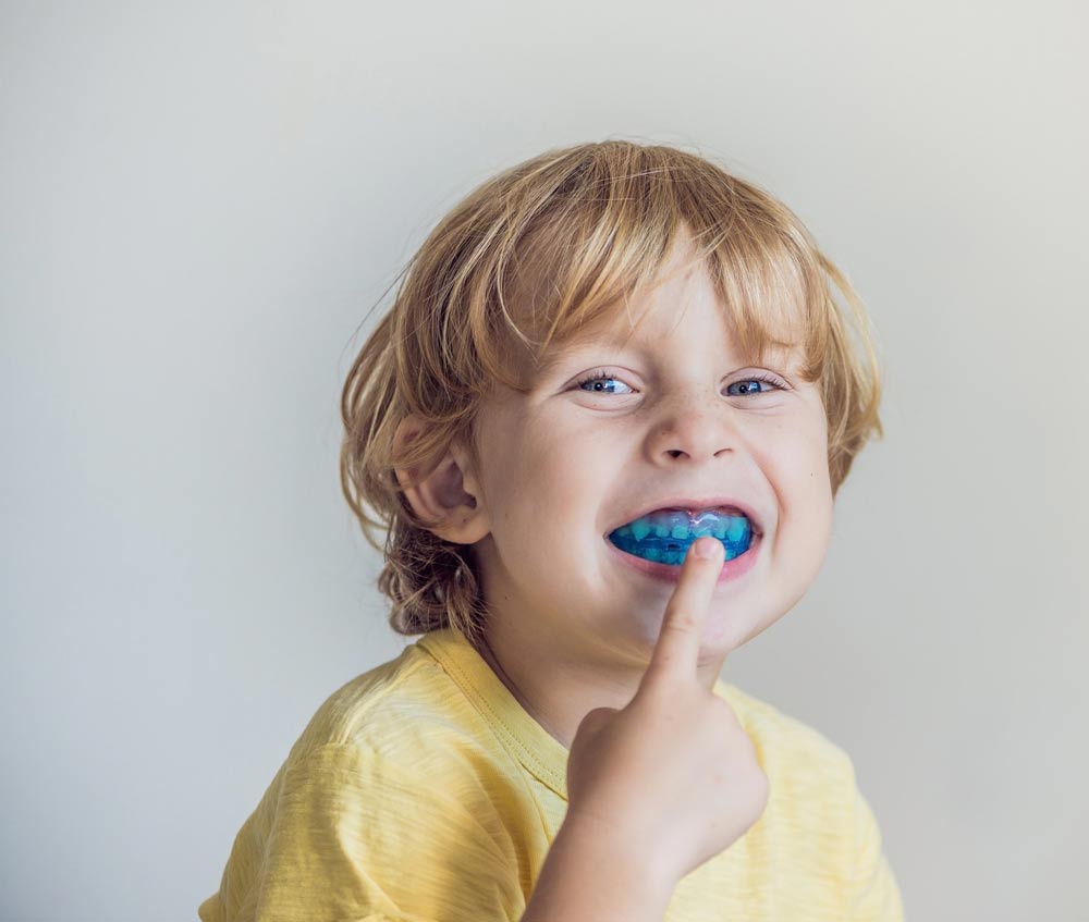 mouth guards