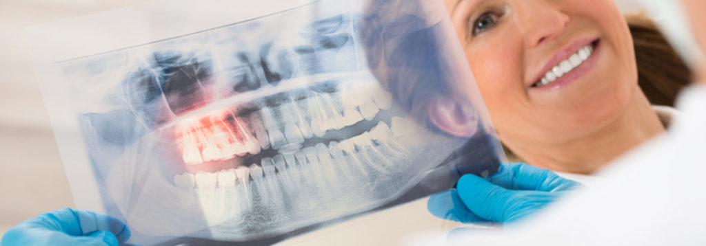 Dentist With Teeth X-ray In Front Of Woman